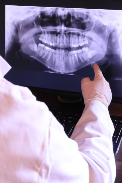 Best Emergency Broken Tooth Repair in Fort Dick, CA