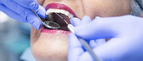 Best Emergency Root Canal Treatment in Fort Dick, CA
